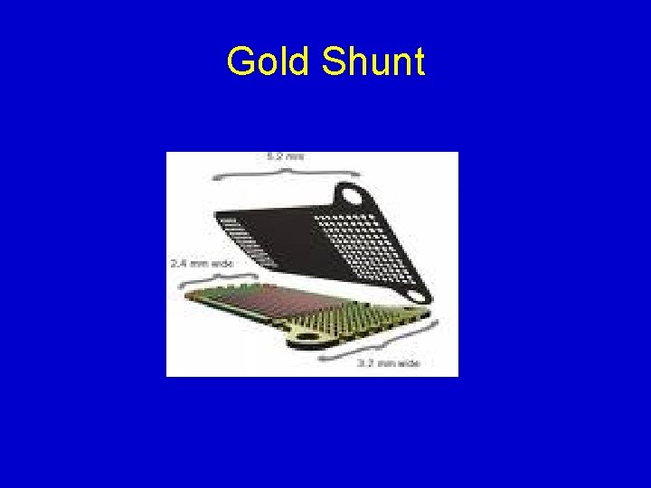 Gold Shunt 