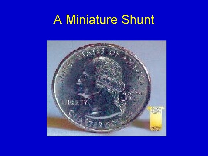 A Miniature Shunt 