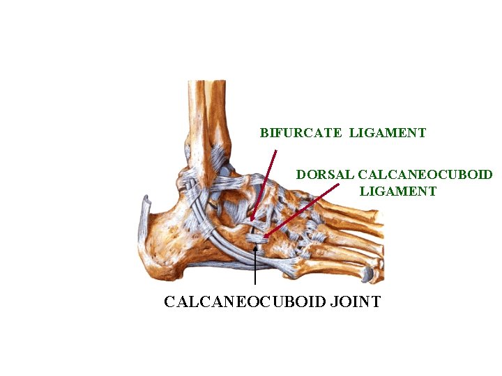 BIFURCATE LIGAMENT DORSAL CALCANEOCUBOID LIGAMENT CALCANEOCUBOID JOINT 