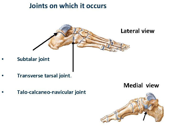 Joints on which it occurs Lateral view • Subtalar joint • Transverse tarsal joint.
