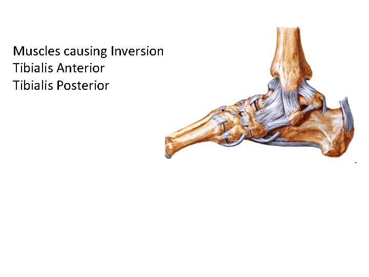 Muscles causing Inversion Tibialis Anterior Tibialis Posterior 