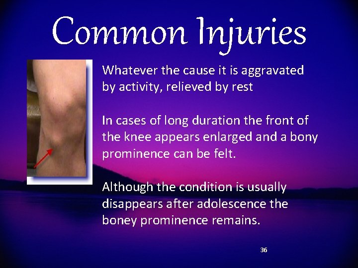 Common Injuries Whatever the cause it is aggravated by activity, relieved by rest In