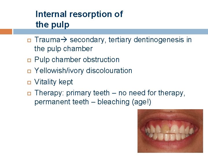 Internal resorption of the pulp Trauma secondary, tertiary dentinogenesis in the pulp chamber Pulp