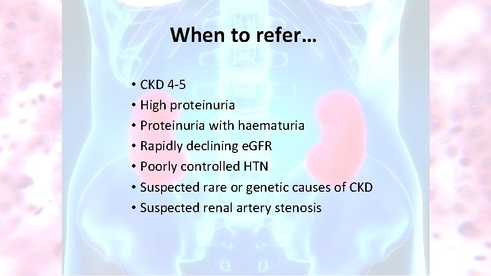 When to refer… • CKD 4 -5 • High proteinuria • Proteinuria with haematuria