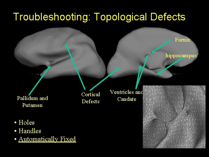 Troubleshooting: Topological Defects Fornix hippocampus Pallidum and Putamen • Holes • Handles • Automatically