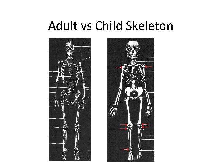 Adult vs Child Skeleton → → ← ← ← 
