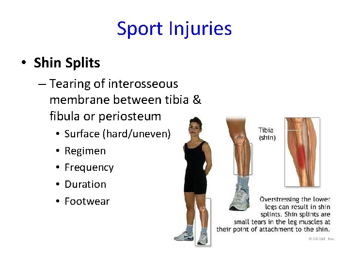 Sport Injuries • Shin Splits – Tearing of interosseous membrane between tibia & fibula