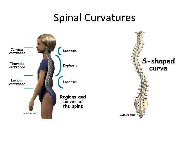 Spinal Curvatures 