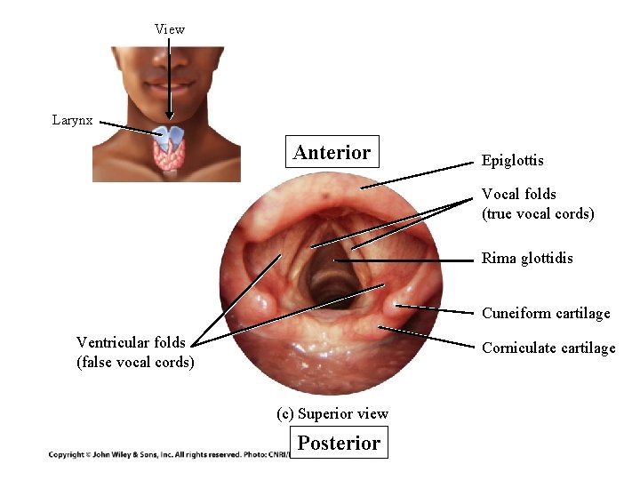 View Larynx Anterior Epiglottis Vocal folds (true vocal cords) Rima glottidis Cuneiform cartilage Ventricular