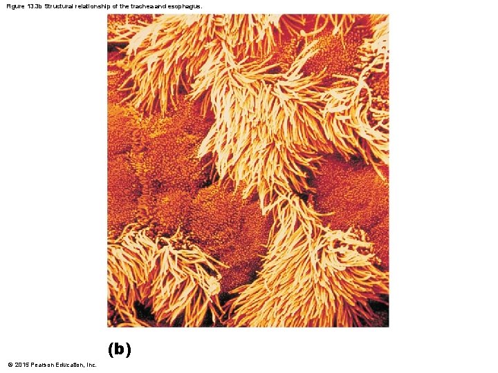 Figure 13. 3 b Structural relationship of the trachea and esophagus. (b) © 2015