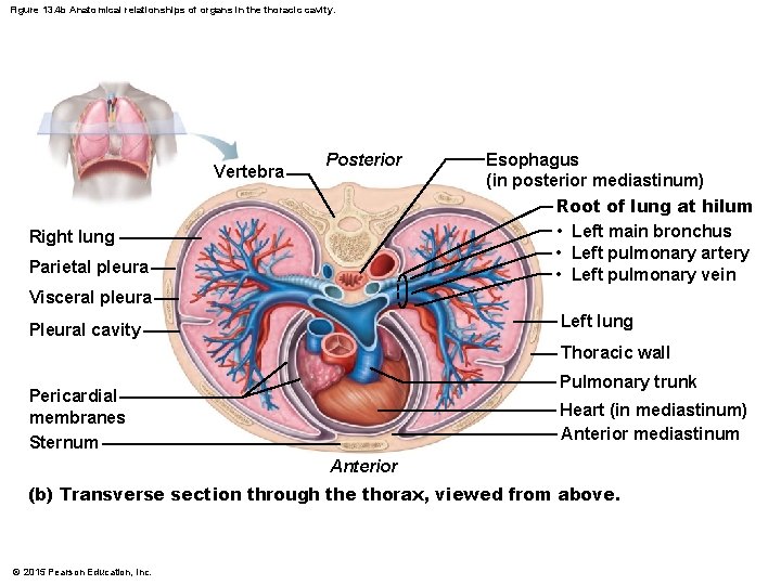 Figure 13. 4 b Anatomical relationships of organs in the thoracic cavity. Vertebra Posterior