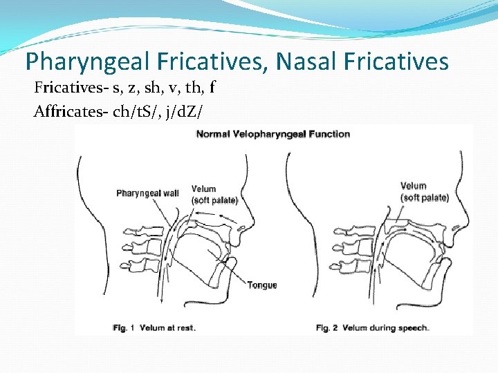 Pharyngeal Fricatives, Nasal Fricatives- s, z, sh, v, th, f Affricates- ch/t. S/, j/d.