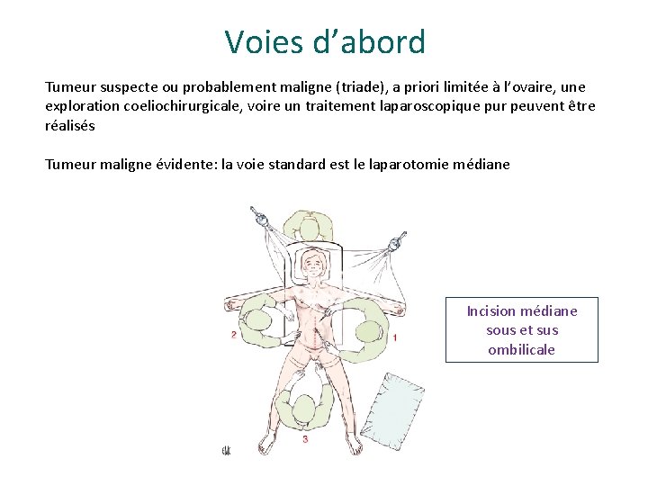 Voies d’abord Tumeur suspecte ou probablement maligne (triade), a priori limitée à l’ovaire, une Voies d’abord Tumeur suspecte ou probablement maligne (triade), a priori limitée à l’ovaire, une