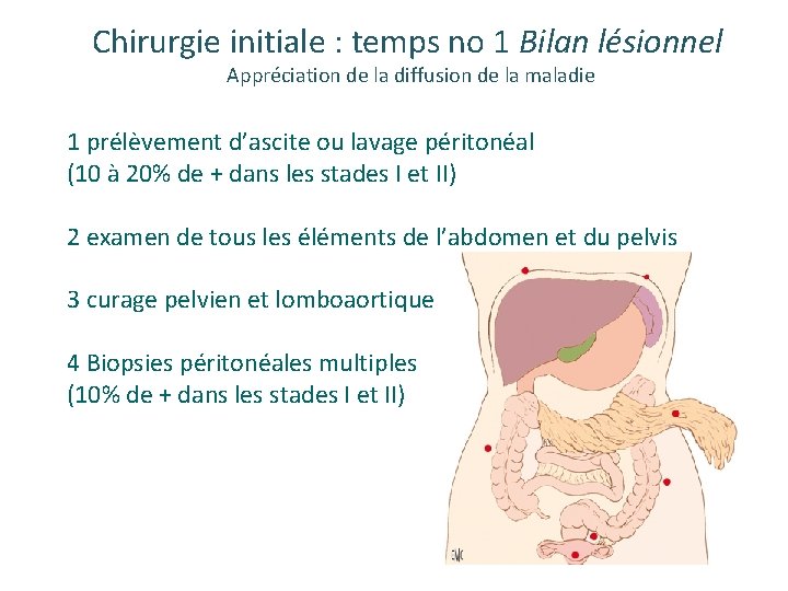 Chirurgie initiale : temps no 1 Bilan lésionnel Appréciation de la diffusion de la Chirurgie initiale : temps no 1 Bilan lésionnel Appréciation de la diffusion de la
