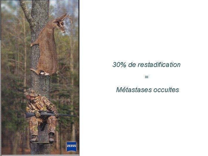 30% de restadification = Métastases occultes 30% de restadification = Métastases occultes