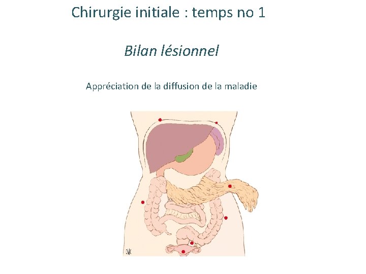 Chirurgie initiale : temps no 1 Bilan lésionnel Appréciation de la diffusion de la Chirurgie initiale : temps no 1 Bilan lésionnel Appréciation de la diffusion de la