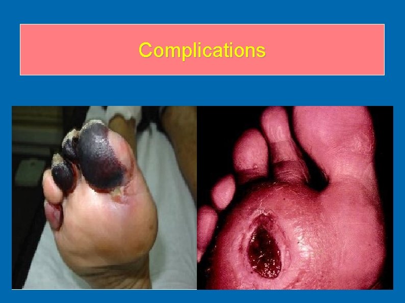 Complications Complications