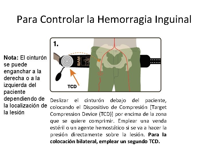 Para Controlar la Hemorragia Inguinal Nota: El cinturón se puede enganchar a la derecha