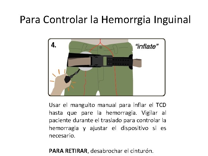 Para Controlar la Hemorrgia Inguinal Usar el manguito manual para inflar el TCD hasta
