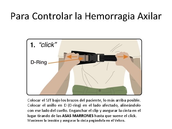 Para Controlar la Hemorragia Axilar Colocar el SJT bajo los brazos del paciente, lo