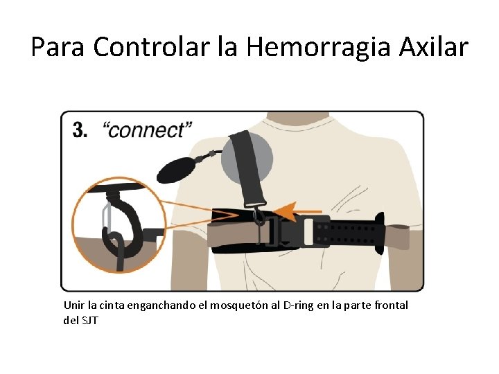 Para Controlar la Hemorragia Axilar Unir la cinta enganchando el mosquetón al D-ring en