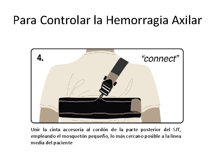 Para Controlar la Hemorragia Axilar Unir la cinta accesoria al cordón de la parte