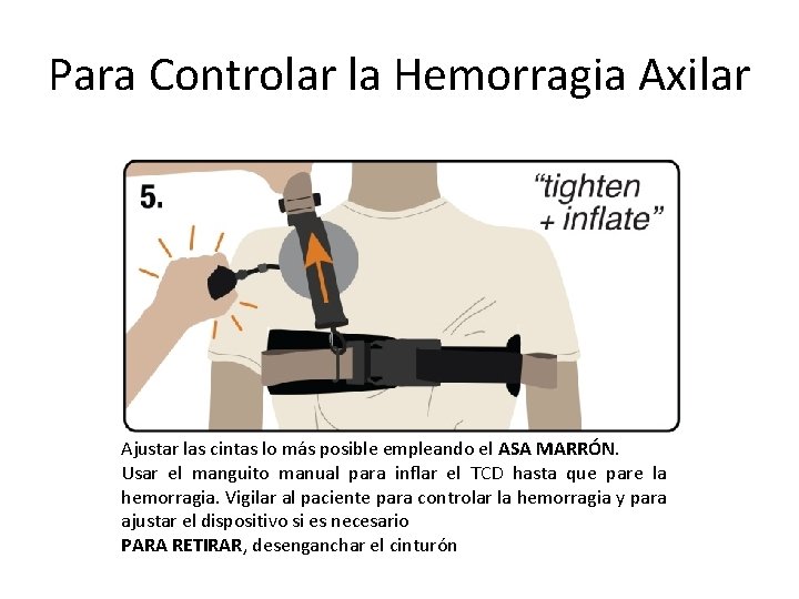 Para Controlar la Hemorragia Axilar Ajustar las cintas lo más posible empleando el ASA