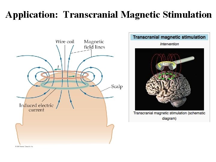 Application: Transcranial Magnetic Stimulation 