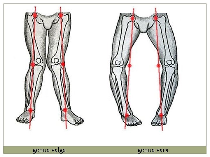 genua valga genua vara 