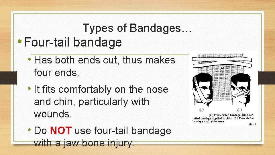 Types of Bandages… • Four-tail bandage • Has both ends cut, thus makes four