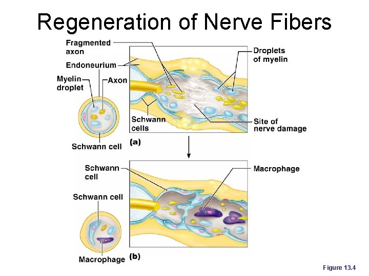 Regeneration of Nerve Fibers Figure 13. 4 