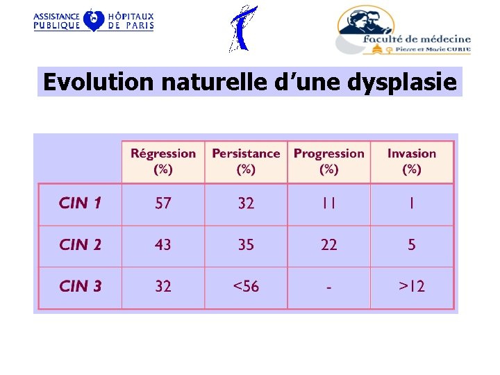 Evolution naturelle d’une dysplasie 