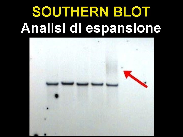 SOUTHERN BLOT Analisi di espansione 