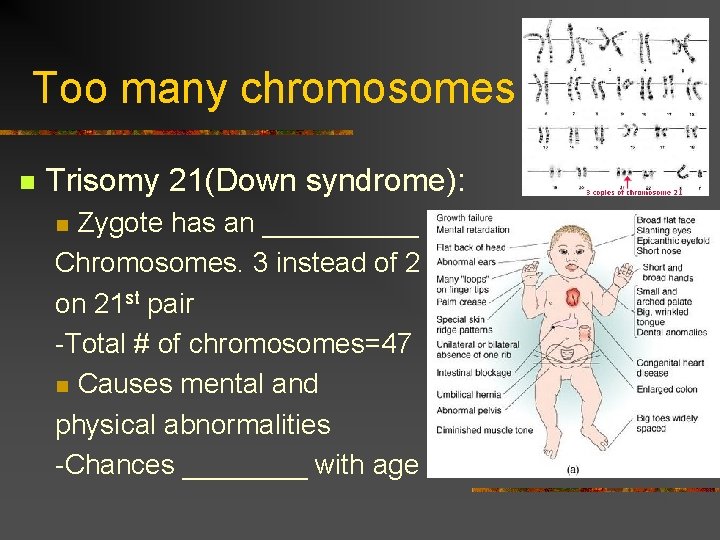Too many chromosomes n Trisomy 21(Down syndrome): Zygote has an _____ Chromosomes. 3 instead