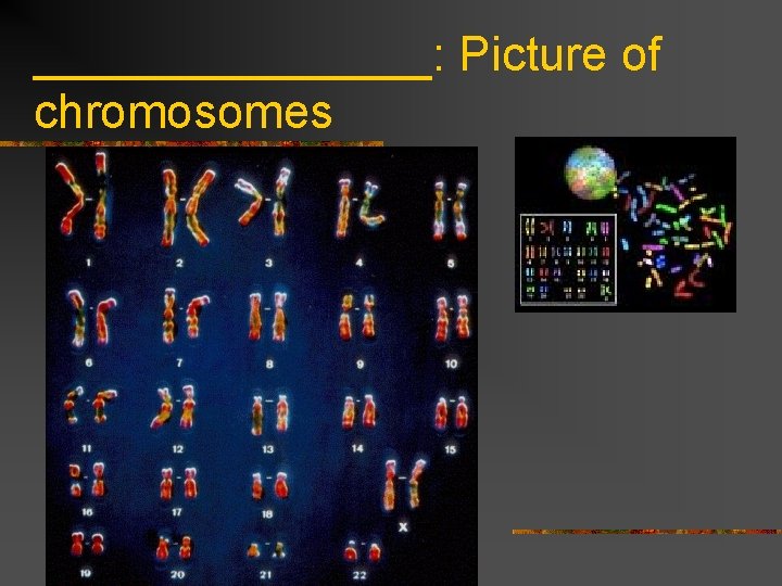 ________: Picture of chromosomes 