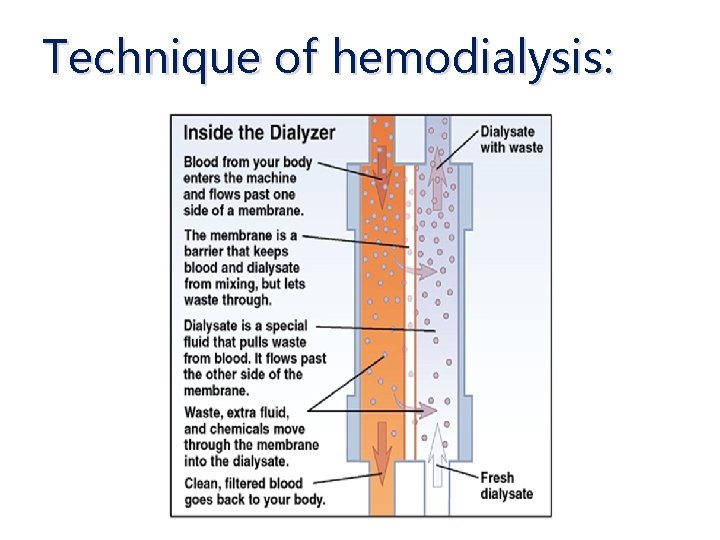Spotlight on general principles of hemodialysis Mohammed Wahba