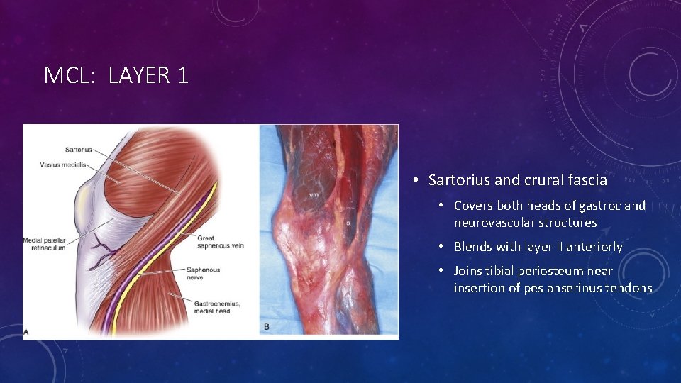 MCL: LAYER 1 • Sartorius and crural fascia • Covers both heads of gastroc