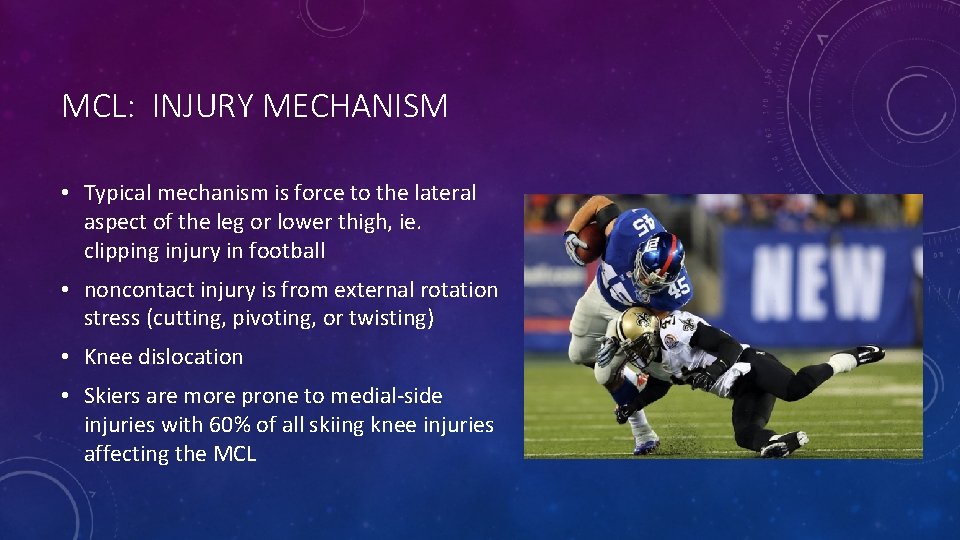 MCL: INJURY MECHANISM • Typical mechanism is force to the lateral aspect of the