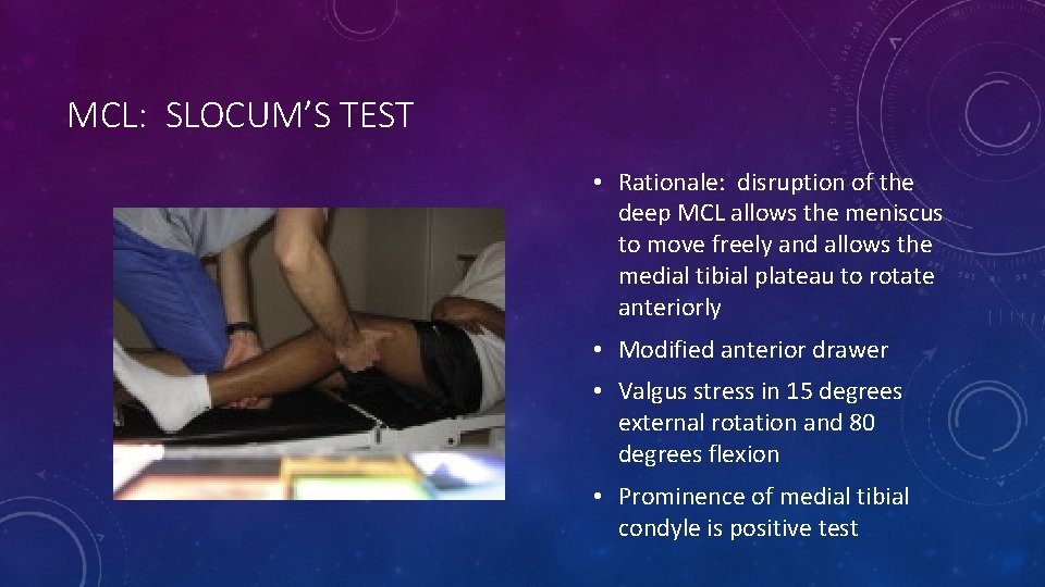 MCL: SLOCUM’S TEST • Rationale: disruption of the deep MCL allows the meniscus to