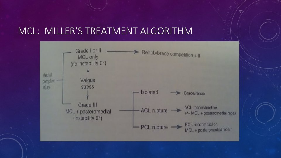 MCL: MILLER’S TREATMENT ALGORITHM 