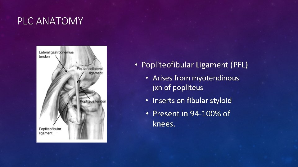PLC ANATOMY • Popliteofibular Ligament (PFL) • Arises from myotendinous jxn of popliteus •