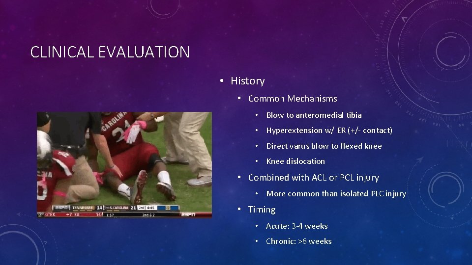 CLINICAL EVALUATION • History • Common Mechanisms • Blow to anteromedial tibia • Hyperextension