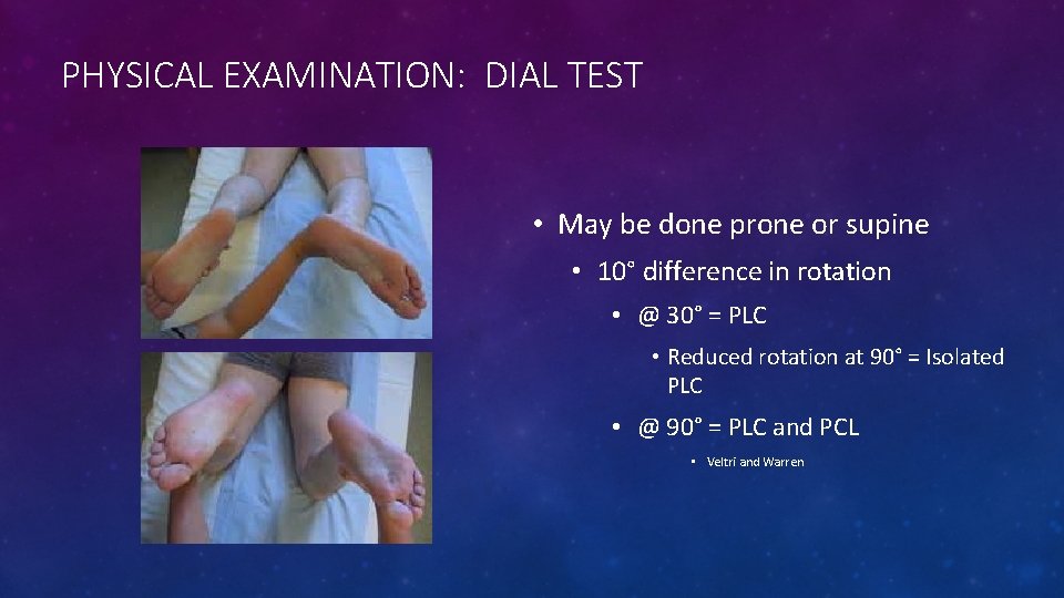 PHYSICAL EXAMINATION: DIAL TEST • May be done prone or supine • 10° difference