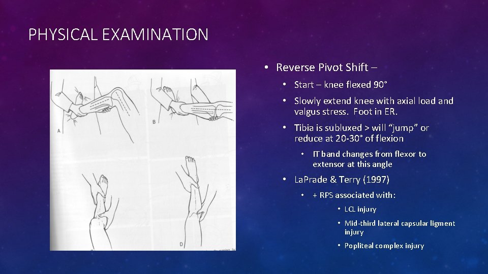 PHYSICAL EXAMINATION • Reverse Pivot Shift – • Start – knee flexed 90° •