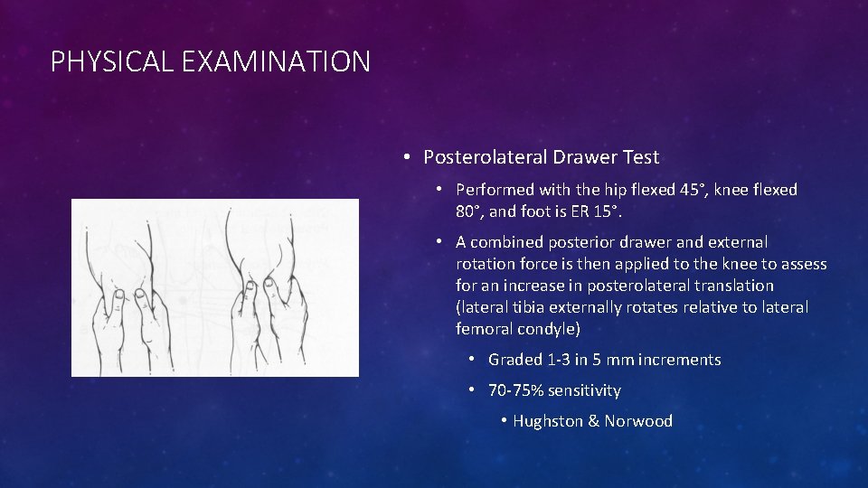 PHYSICAL EXAMINATION • Posterolateral Drawer Test • Performed with the hip flexed 45°, knee