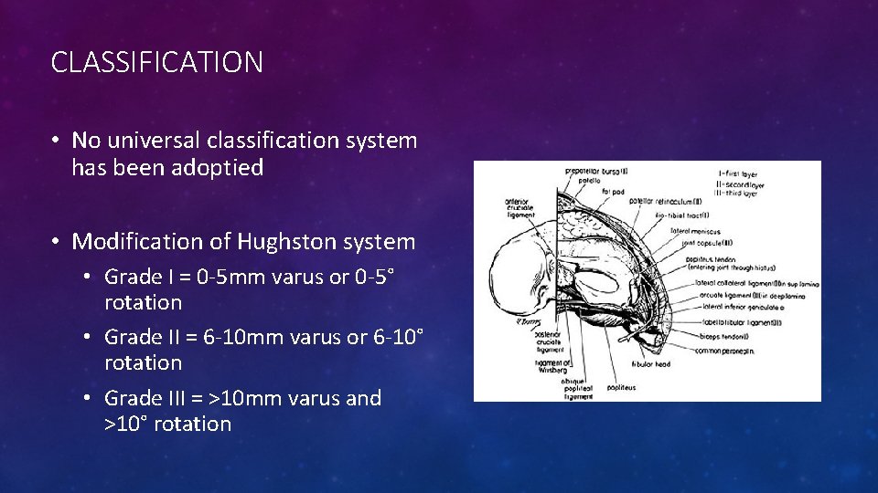 CLASSIFICATION • No universal classification system has been adoptied • Modification of Hughston system