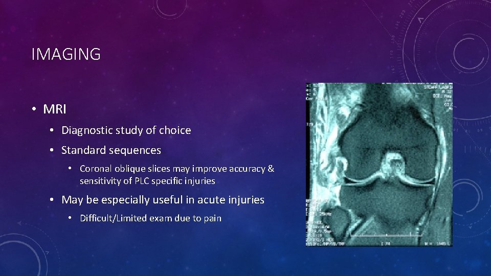 IMAGING • MRI • Diagnostic study of choice • Standard sequences • Coronal oblique