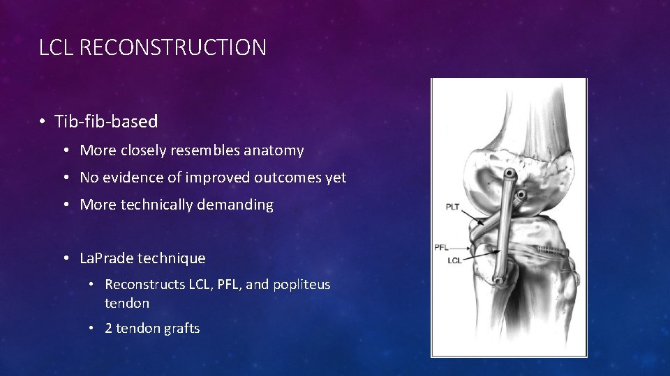 LCL RECONSTRUCTION • Tib-fib-based • More closely resembles anatomy • No evidence of improved