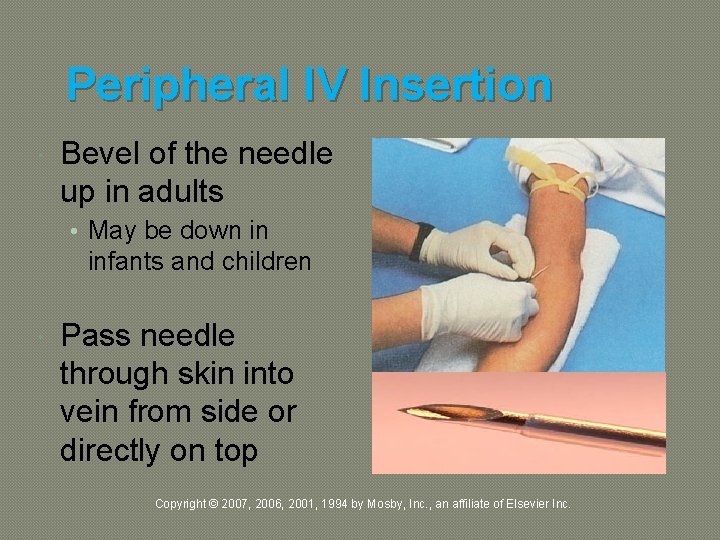 Peripheral IV Insertion Bevel of the needle up in adults • May be down