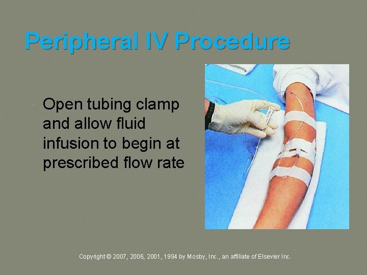 Peripheral IV Procedure Open tubing clamp and allow fluid infusion to begin at prescribed